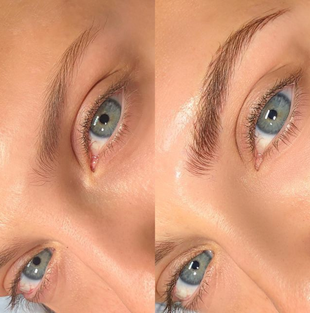 Microblading